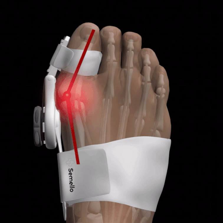 Attelle de Compression Sportive